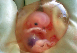 10 Week Old Embryo